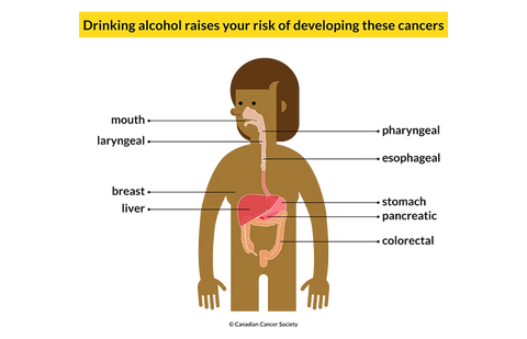 Drinking Less is Better - Some sobering facts about alcohol and cancer risk
