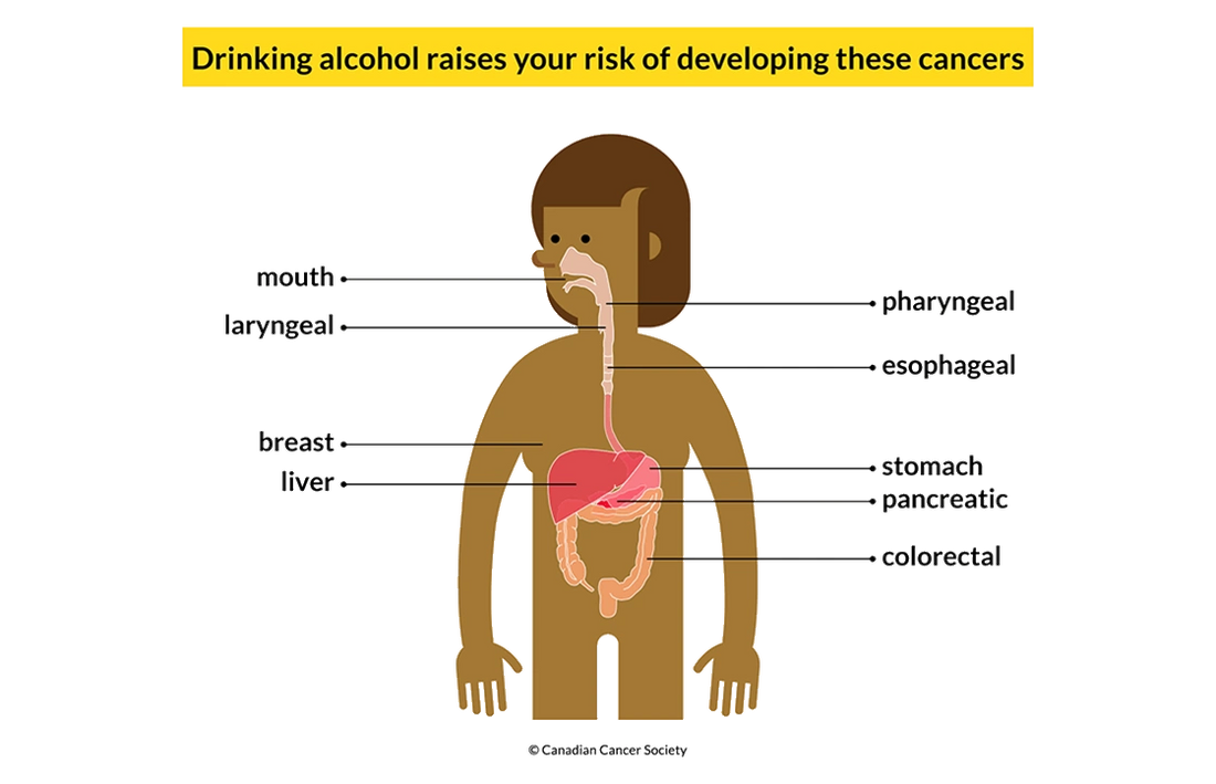 Drinking Less is Better - Some sobering facts about alcohol and cancer risk